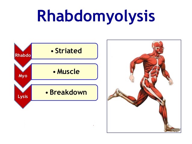 rhabdomyolysis-1-638