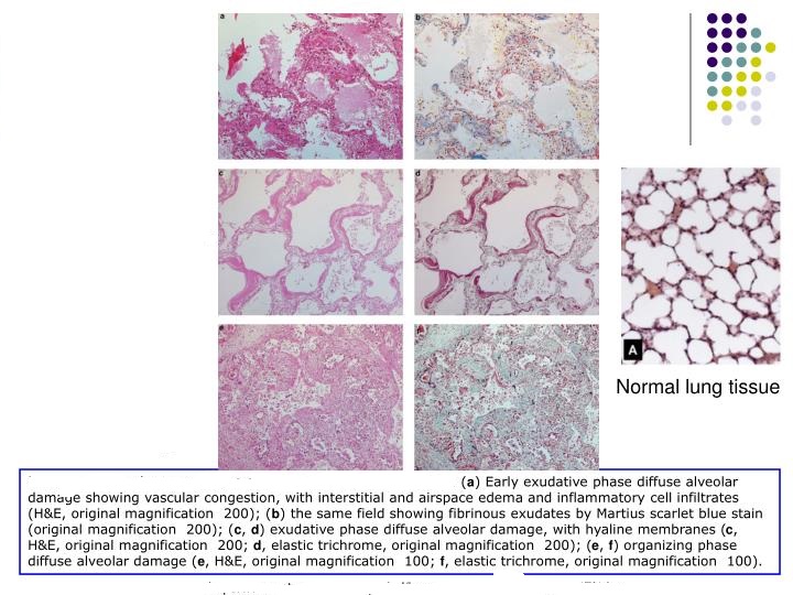 lung-pathology-n